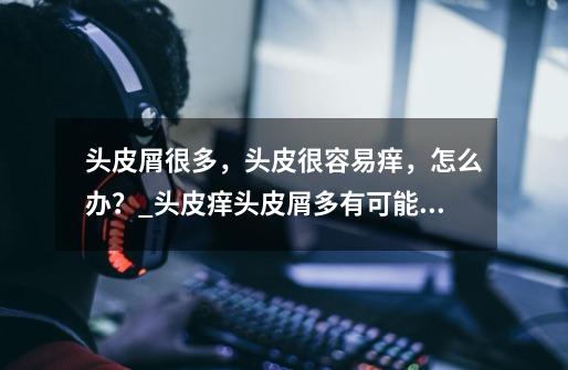 头皮屑很多,头皮很容易痒,怎么办?_头皮痒头皮屑多有可能传染吗 绝对不可能 有可能-第1张-游戏资讯-龙启网络